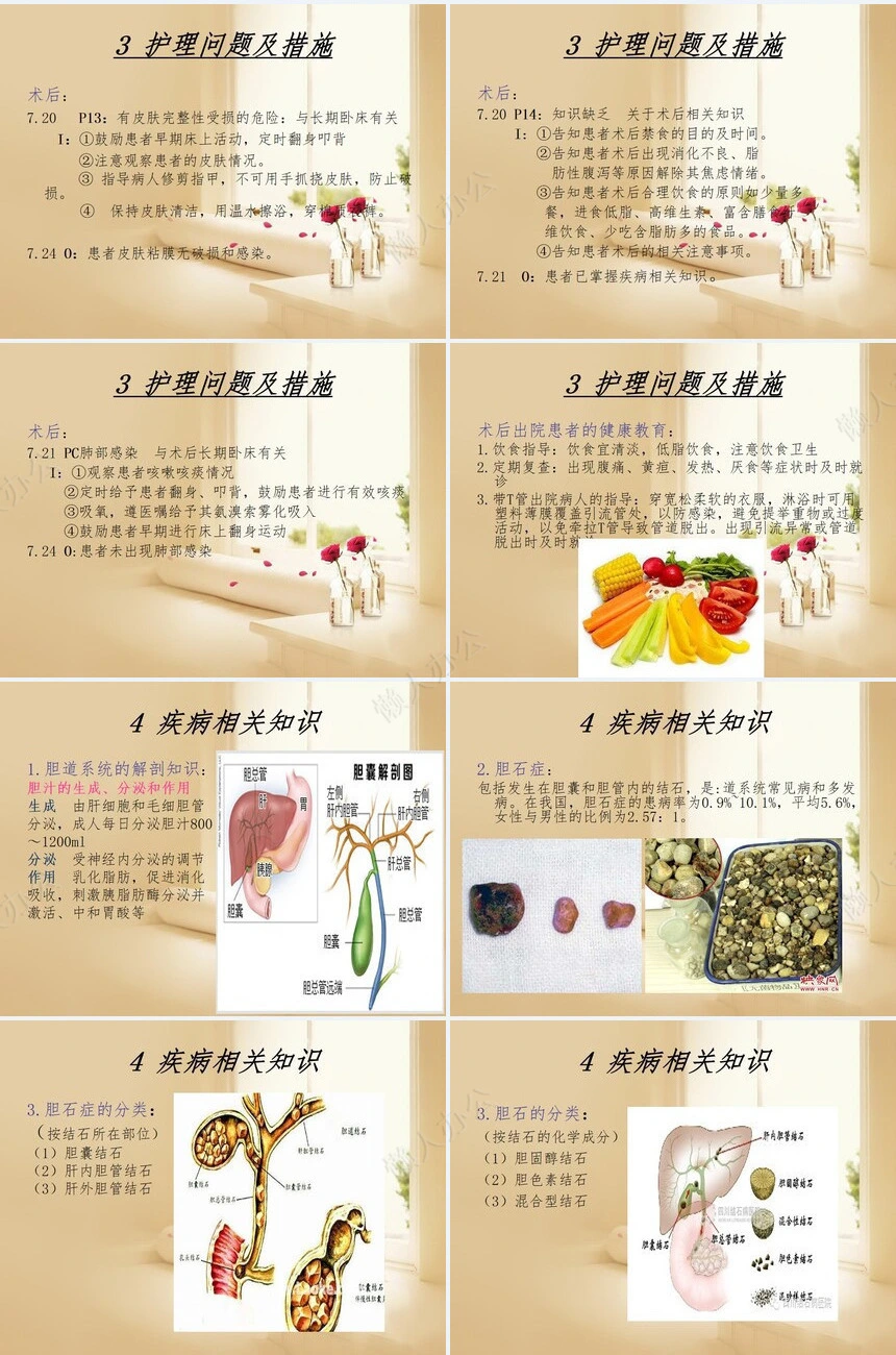 胆总管结石患者的围手术期的护理