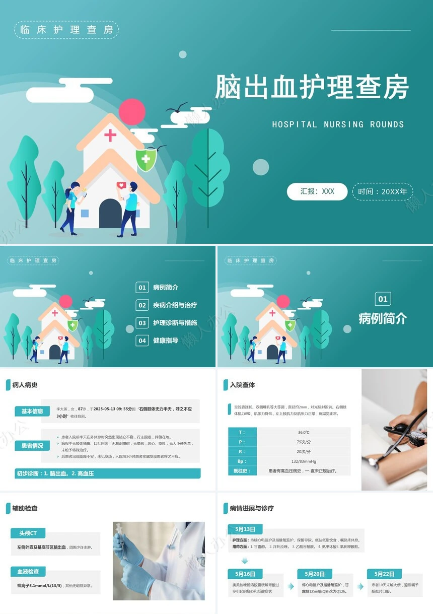 脑出血护理查房