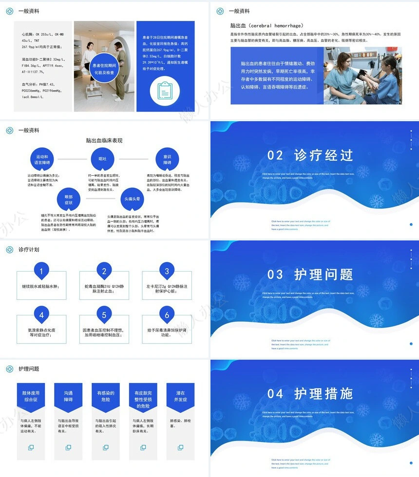 脑出血破入脑室(2)