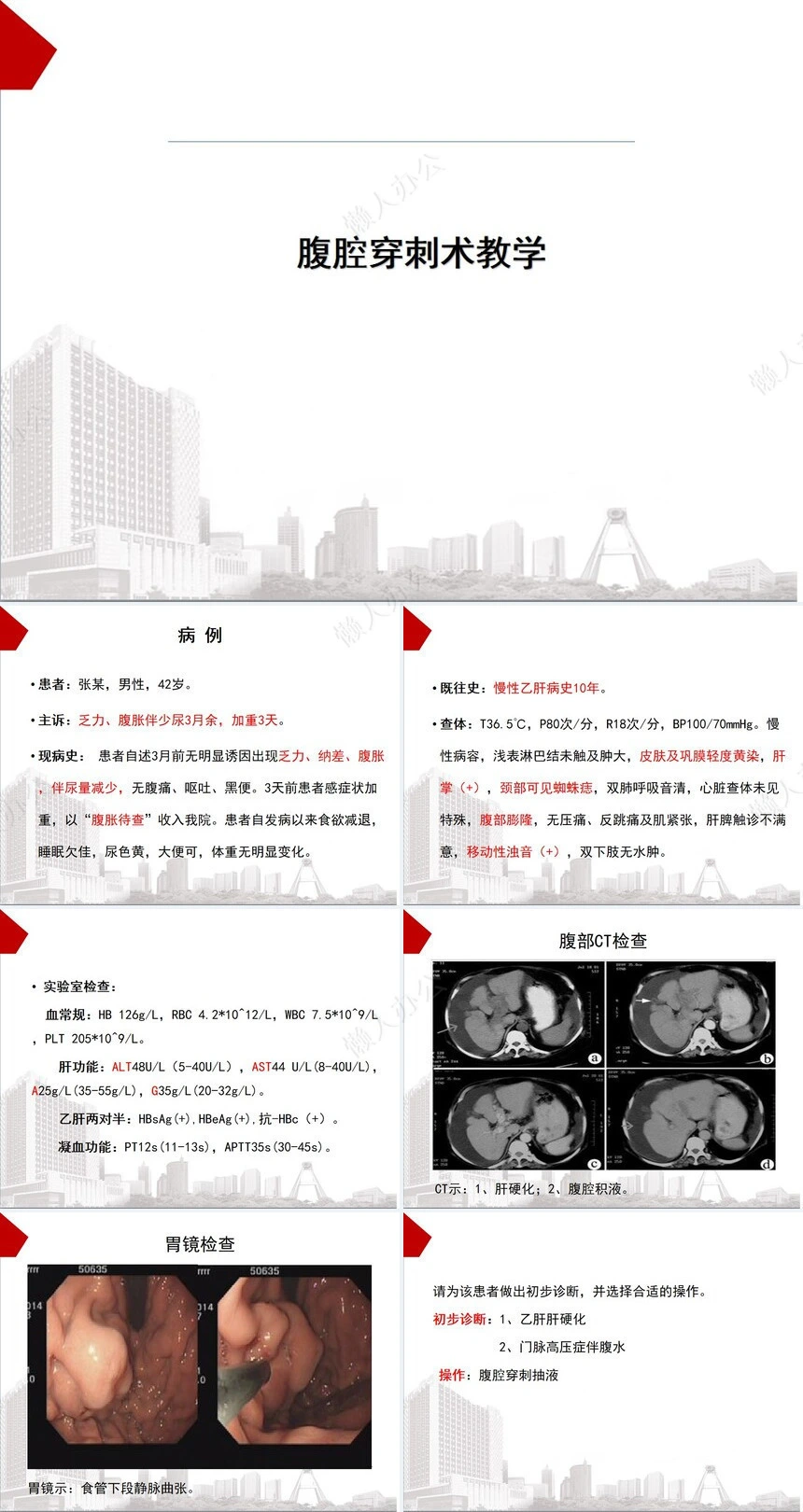 腹腔穿刺术教学