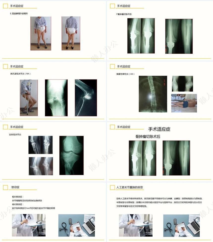 膝关节置换术后护理查房