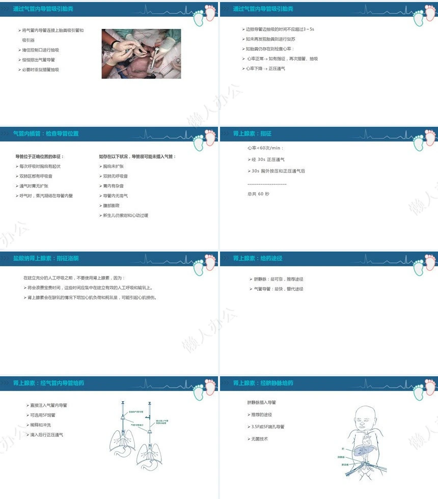 蓝色医疗新生儿复苏CPR护理PPT