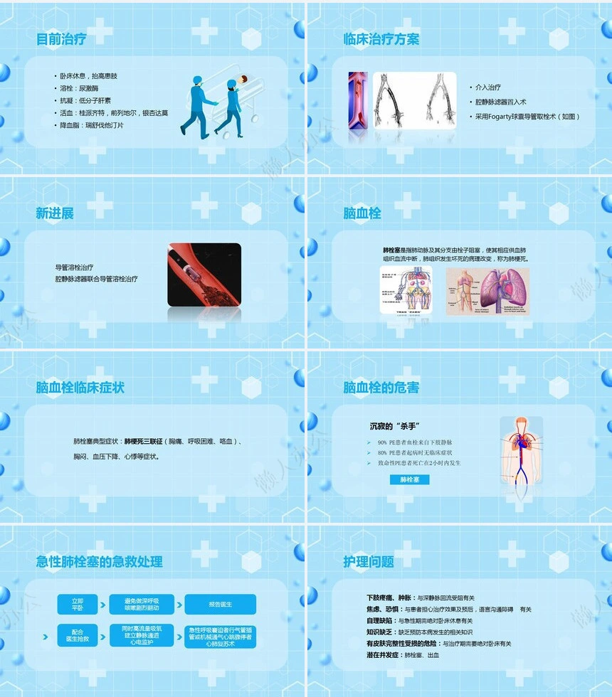 蓝色清新简约医学医疗下肢静脉血栓的护理查房ppt