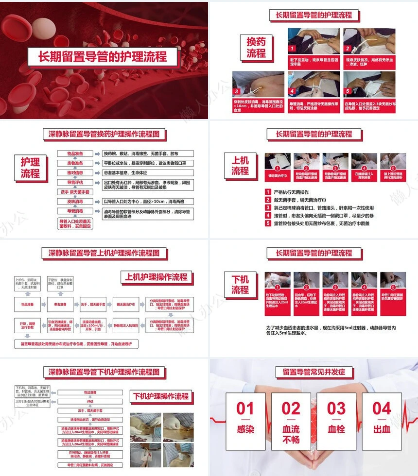 血液透析留置导管护理