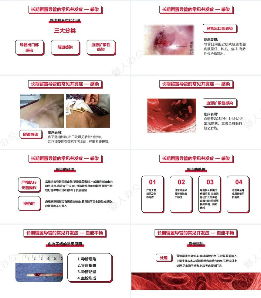 血液透析留置导管护理