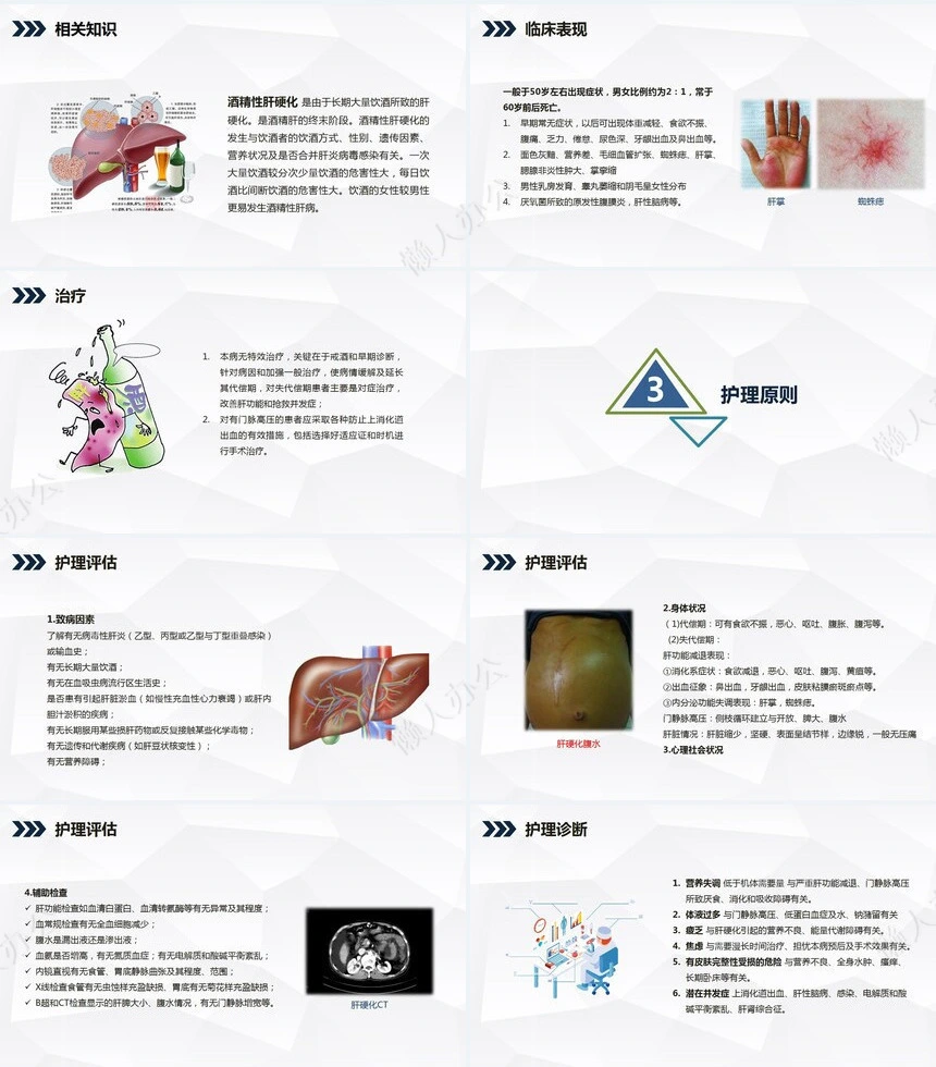 酒精性肝硬化护理教学查房