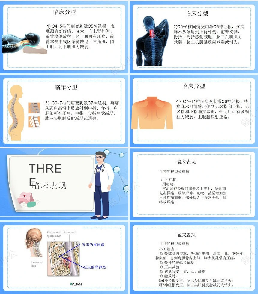 颈椎病病人的护理