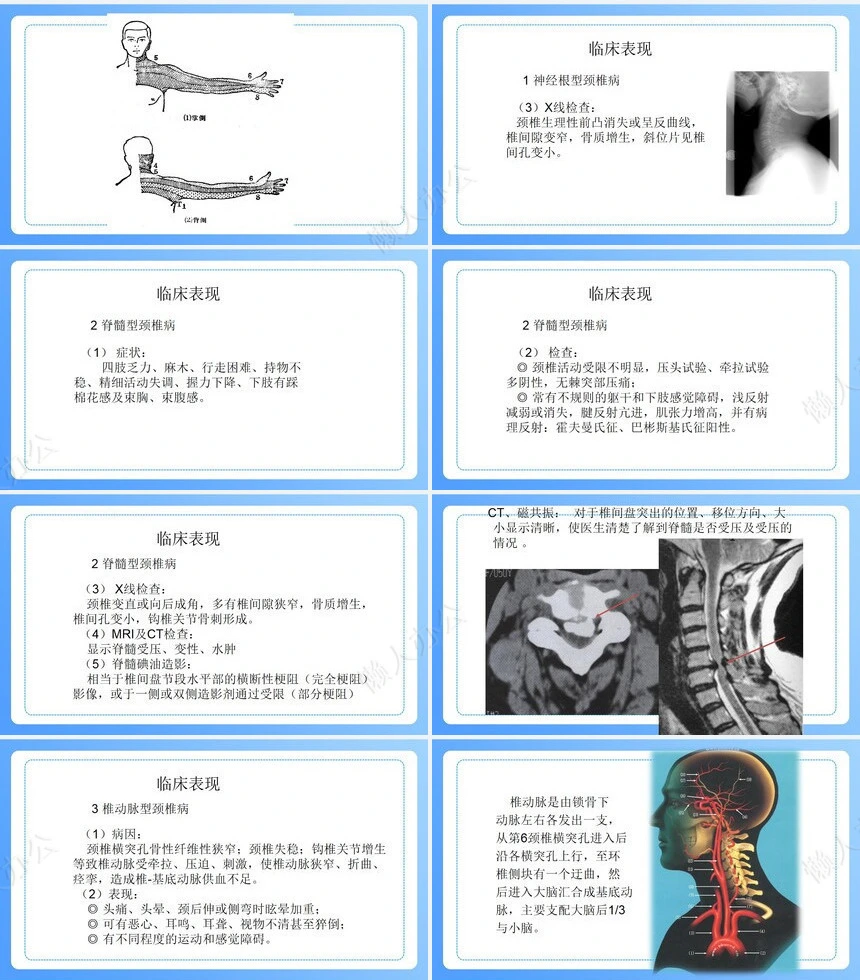 颈椎病病人的护理